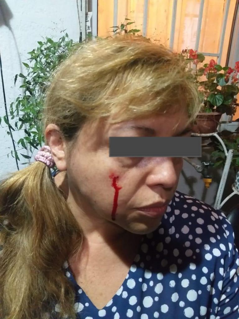 El relato de la periodista Ana María Olivares herida con balines metálicos al interior de su hogar junto a reportero gráfico