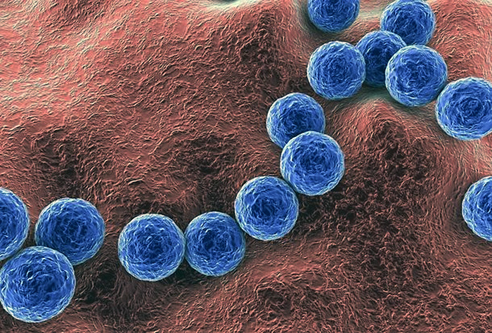 ¿Qué es el Streptococcus pyogenes? Explican cuándo puede complicarse un cuadro infeccioso por esta bacteria
