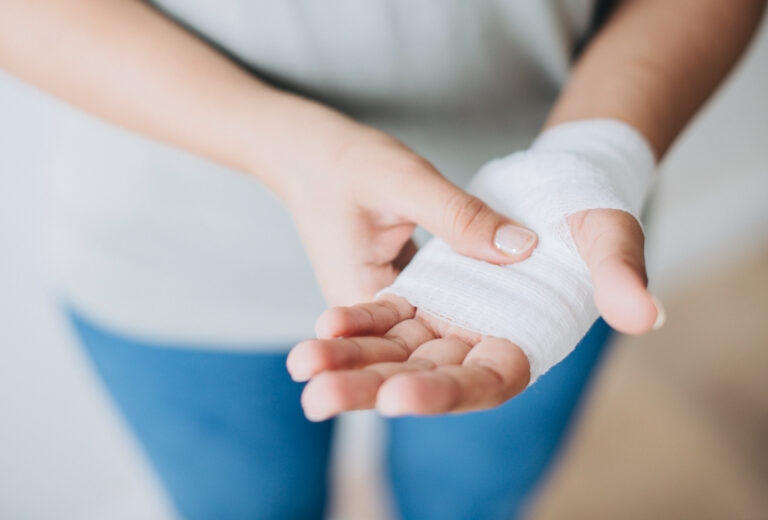Medidas preventivas en invierno: Cómo reducir el riesgo de quemaduras en el hogar