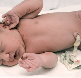 [Podcast] Especialista médico explica beneficios de las células madres del cordón umbilical