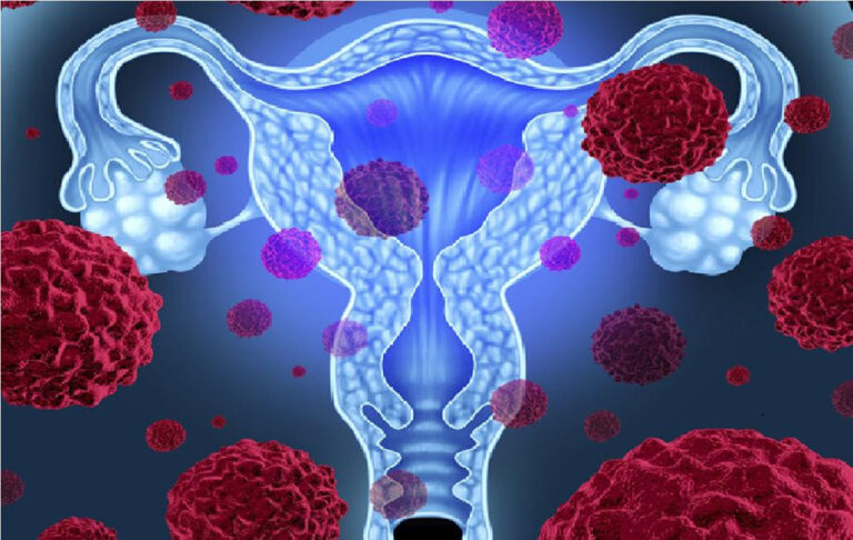 Virus del Papiloma Humano (VPH): Aunque no haya síntomas o signos puede estar presente en tu cuerpo